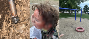 Lara Grillos's son, Asher, was playing on the tire swing in 2024 when the bolt at the top broke and struck him. He was rushed to the hospital, where he received 4 staples on the top of his head.